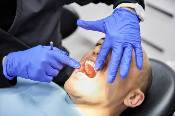 Best Knocked-Out Tooth Emergency  in Doral, FL